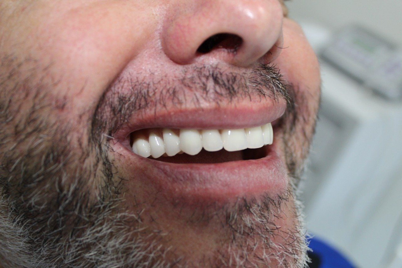 Protocolo Dentário Edson